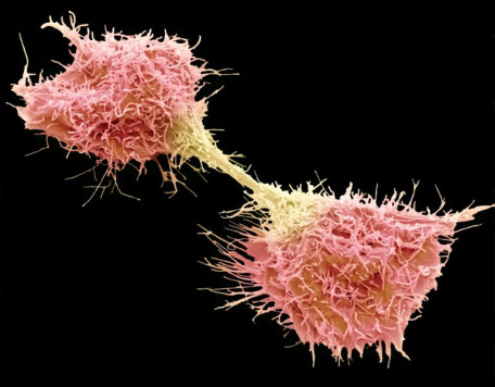 Cancer cell